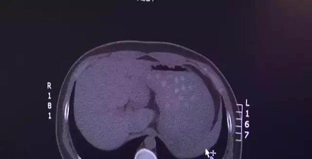 高中生总是肚子痛是什么原因,高中生生理期间肚子疼怎么办