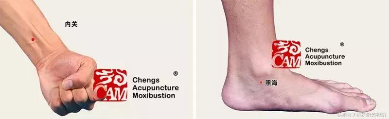 顽固性便秘董氏针灸,便秘的针灸辨证论治