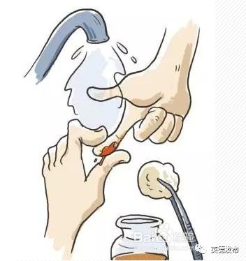 广东英德蛇咬伤人事件,广州英德最近被蛇咬事件