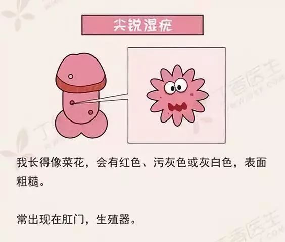 「健康」李东升：尖锐湿疣不可怕