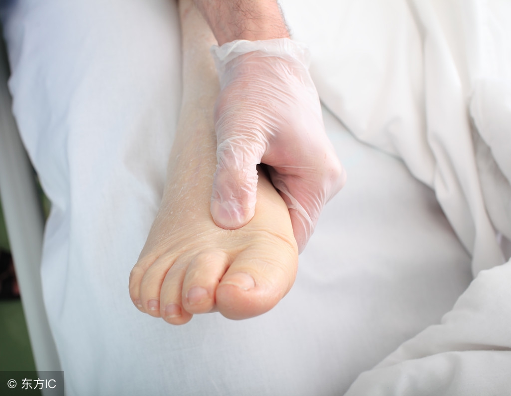 孕期水肿怎么办快来get解决方案,孕期水肿不可怕6招教你轻松缓解