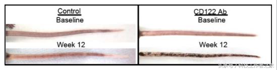 厉害！抹掉T细胞的记忆或能逆转白癜风症状