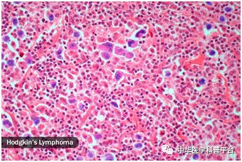 盗汗的可能原因有哪些,盗汗的原因男士