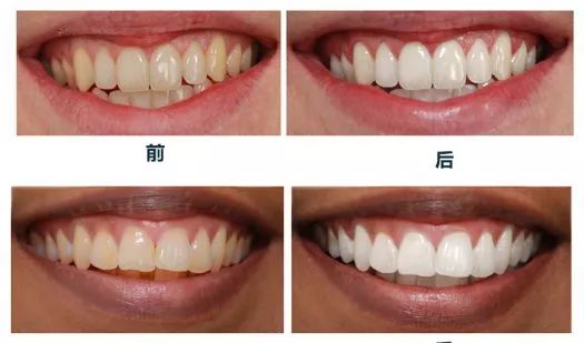 网红测评比较好的牙膏,哪些牙膏是大品牌