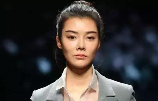 豪门梦碎后颜值大跌的她,一直被吐槽的“猪鼻子”居然不见了?