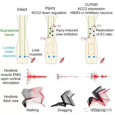 脊髓受损恢复的小孩,脊髓损伤下肢瘫痪恢复行走的案例