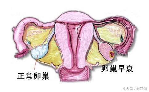 32岁女子半年多没来月经，只因她忽略了1件事