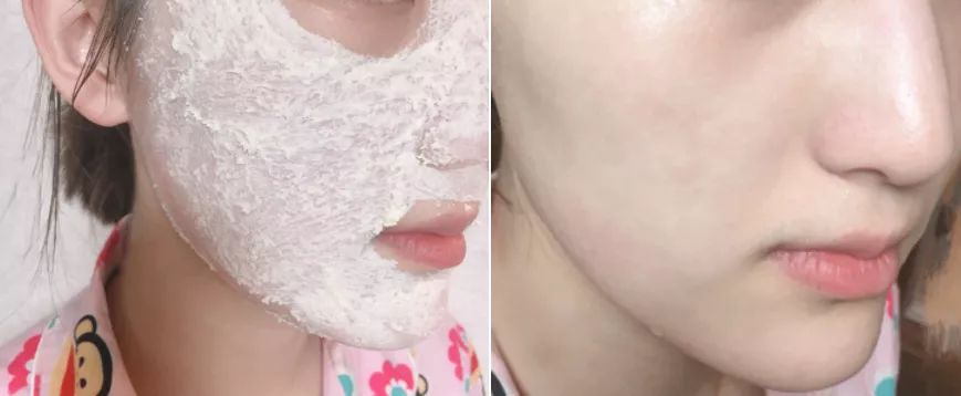 断货半年，抢都抢不到！荣登Cosme榜首，用完肌肤嫩到爆