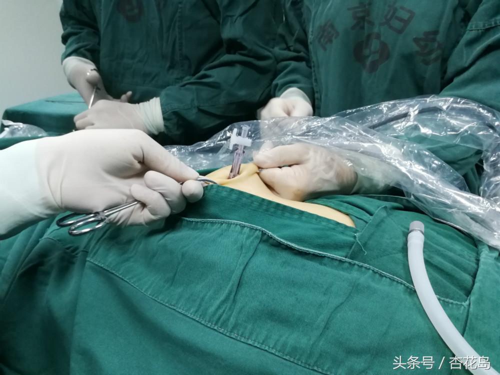 手术切口流黄水,是发生了感染吗?