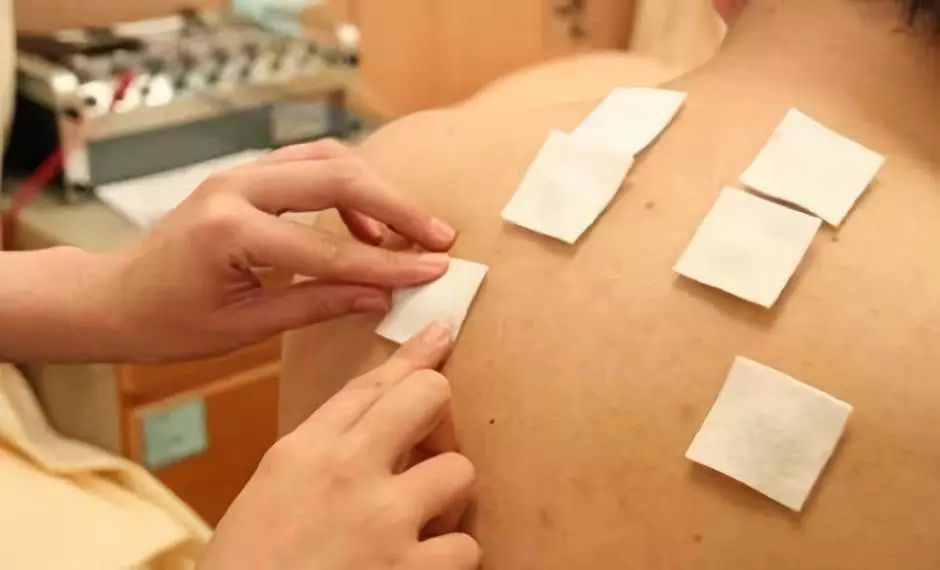 店里员工培训烧伤怎么赔偿,三伏贴培训教学视频