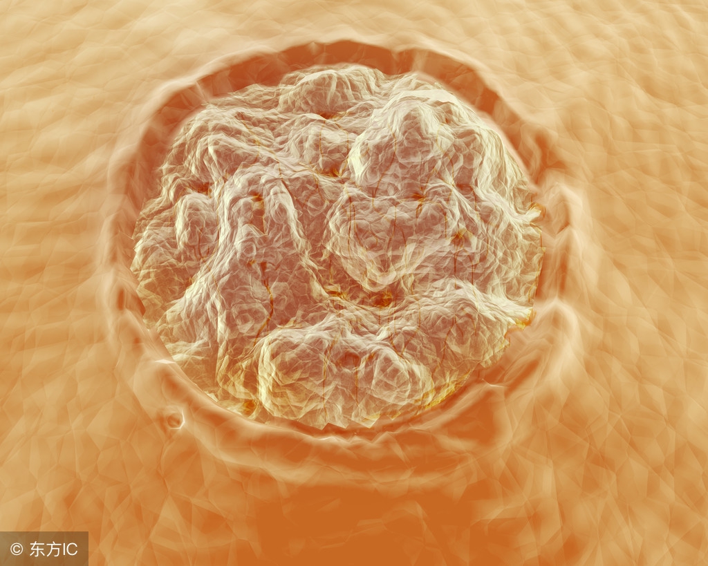 尖锐性湿疣如何预防传染,尖锐性湿疣怎样防止传染