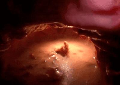 催吐,外挂般的减肥方式?吃的是欲望,吐的是灵魂