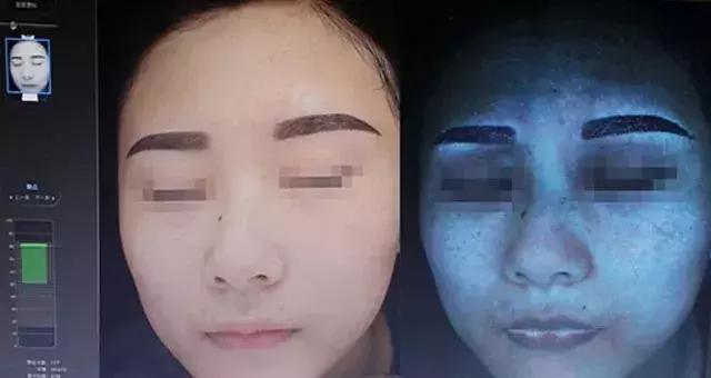 皮肤检测仪从三个层次分析,皮肤检测仪帮你判断皮肤问题