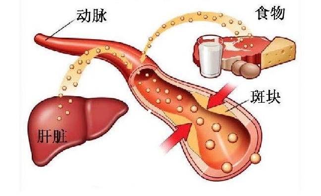 甘油三酯高有没快速降血脂的方法,甘油三酯高怎么调理才会降