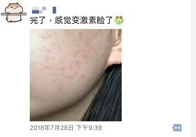 “面子”很重要！这家医院的皮肤科来了“大咖”，还送价值百元的免费挂号名额