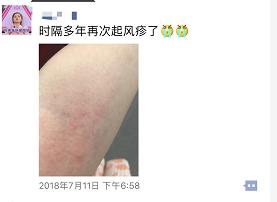 “面子”很重要！这家医院的皮肤科来了“大咖”，还送价值百元的免费挂号名额