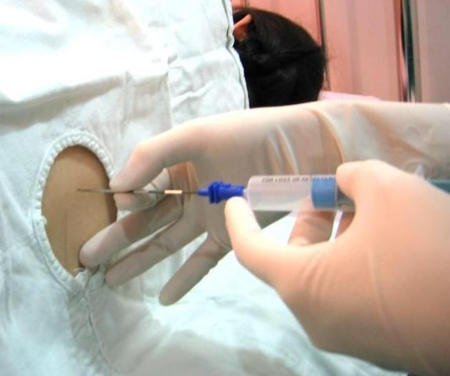 产妇麻醉的几种方法,这三种情况的产妇要注意了