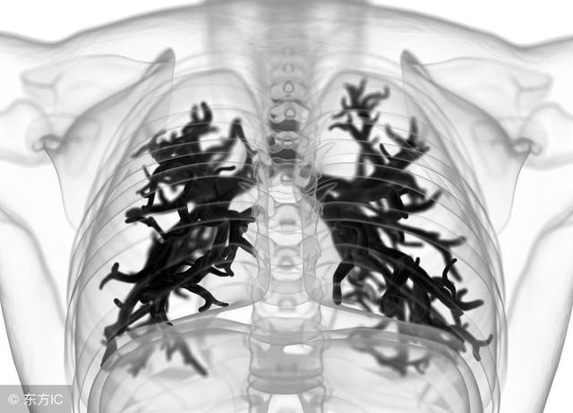 慢性咽喉炎引发支气管炎什么症状,什么叫慢性支气管炎急性发作