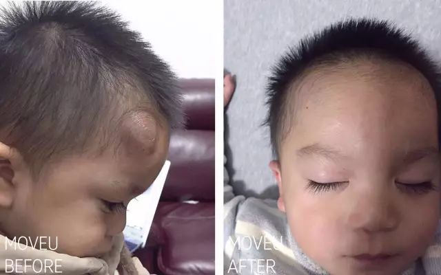 “万用”紫草膏，解决了你多少皮肤烦恼？