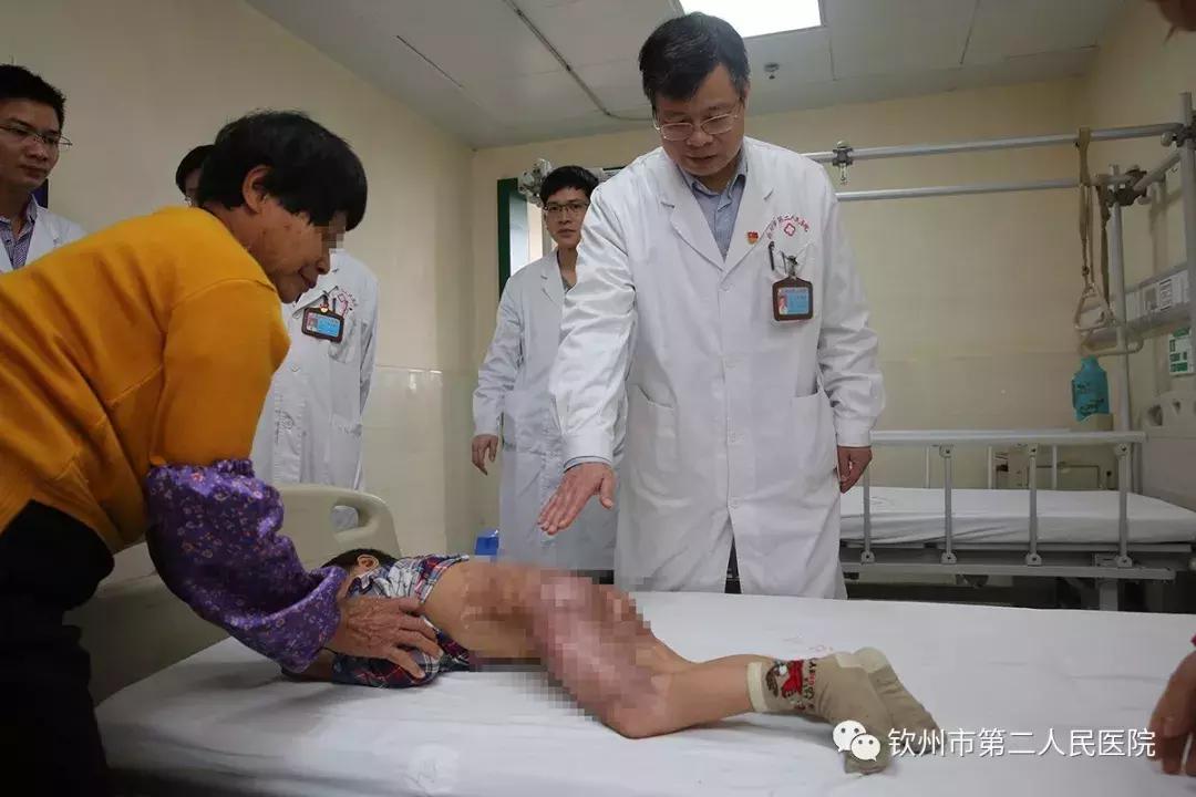 钦州二医关爱门诊,医疗健康扶贫新模式