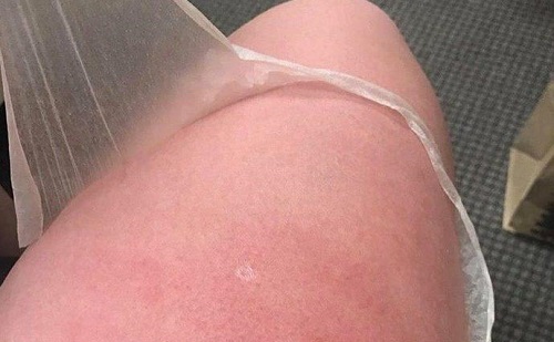 为什么去完海边会掉皮,从海边回来一直掉皮怎么解决