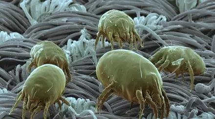 后背螨虫怎么消灭,去后背螨虫最好的方法