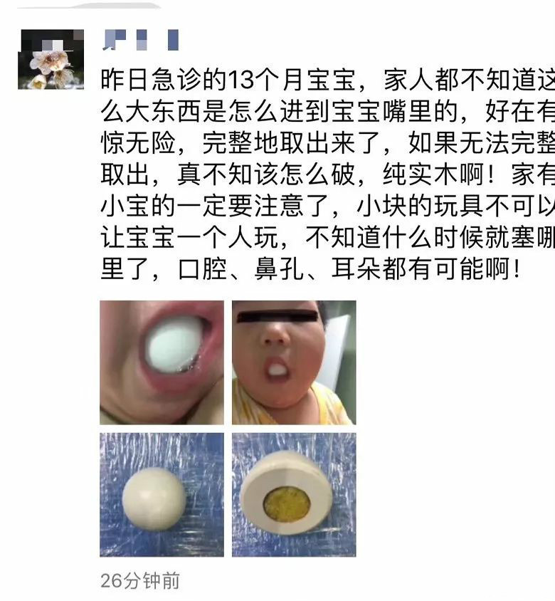 怎么检查宝宝鼻子塞入异物,如何预防孩子将异物塞入