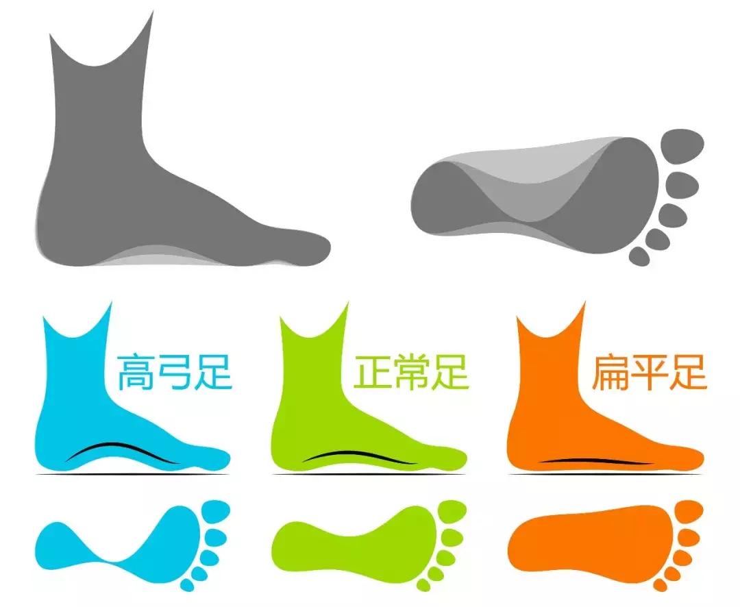 鞋底往外偏是什么原因,鞋底偏斜一边是什么原因