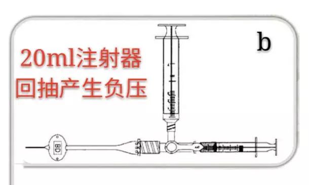 picc堵管用尿激酶剂量,picc堵管了如何用尿激酶通管
