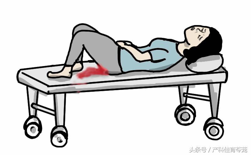 剖宫产横向瘢痕妊娠概率,怀孕7周异位妊娠瘢痕子宫