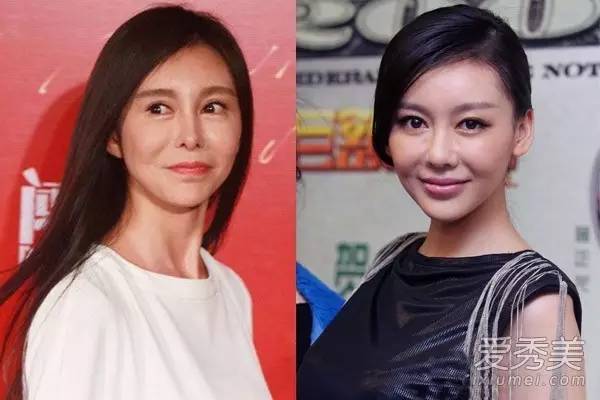 有人劝你打玻尿酸,打玻尿酸的一些常识问题