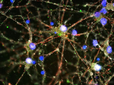 如何使用keras库,keras调用预训练模型