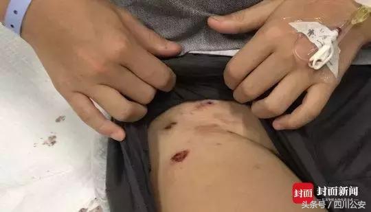 遇到狗咬人怎么自救,遇到狗狗攻击自救方法