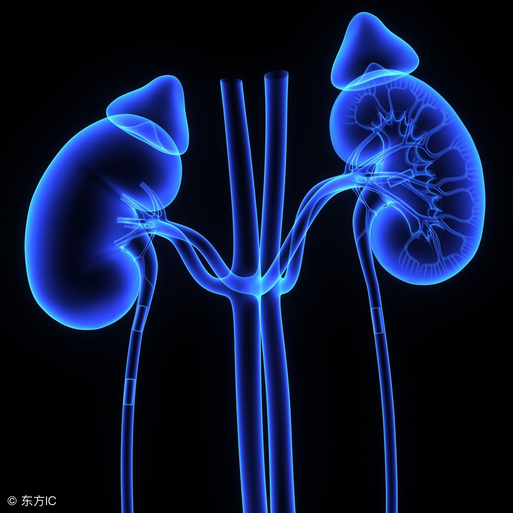 肾结石预防大于治疗!四大早期症状,一定要重视