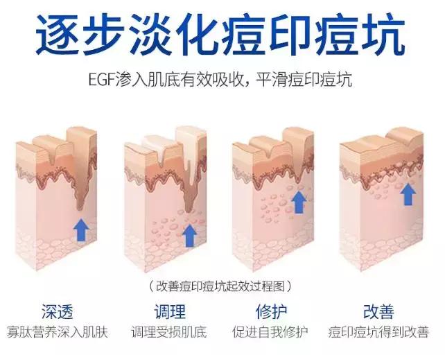 一直被国人瞧不起的老牌国货,老牌国货治好烂脸