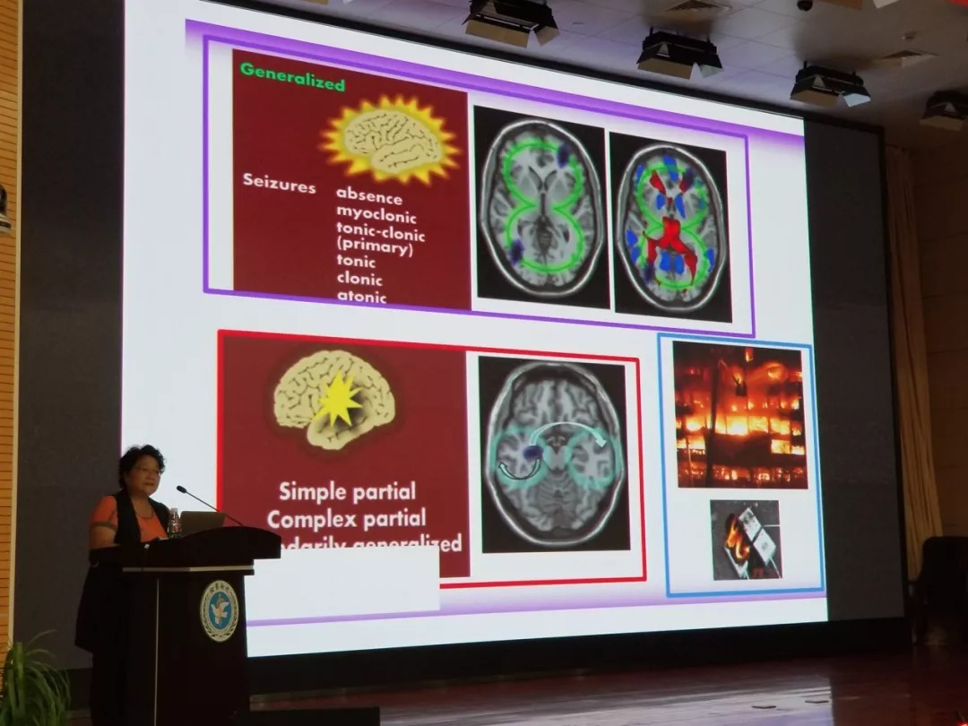 儿童神经内科进修总结,儿童神经系统疾病讲课