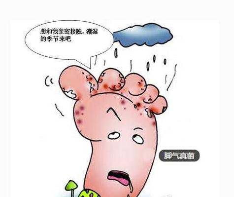 得了严重脚气好丢人怎么办,得了脚气有多尴尬