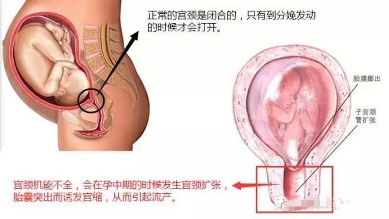 妇幼保健院三胞胎,妇幼保健院4胞胎