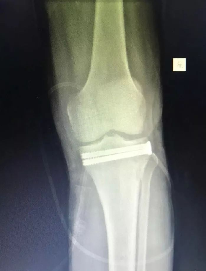 天玑加强版,新一代天玑