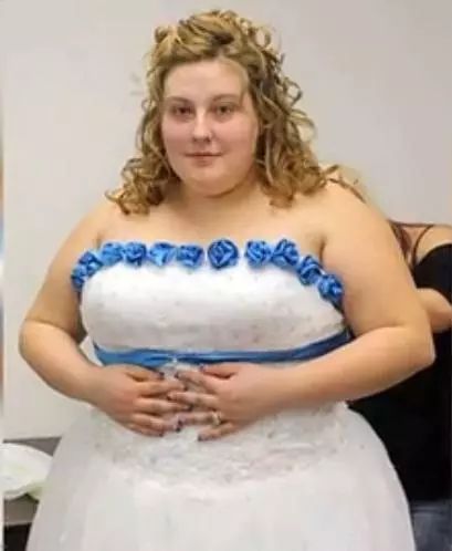 瘦了200斤,身体很多赘皮,怎么办?