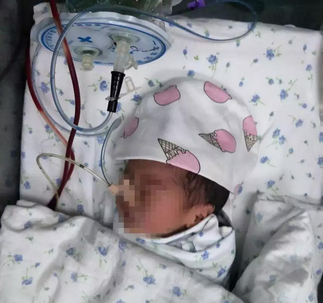 新生儿先天性肠闭锁要多少手术费,婴儿先天性心脏病手术费能报销吗