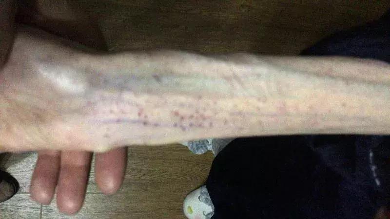 1米67才50斤，看到这个21岁女孩，你还敢“自杀式”减肥吗？