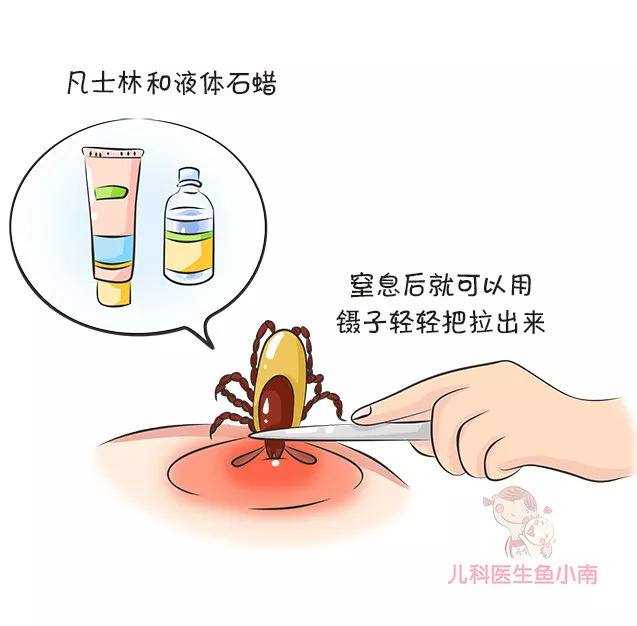 蜱虫咬在孩子头上怎么处理,宝宝如何预防蜱虫叮咬