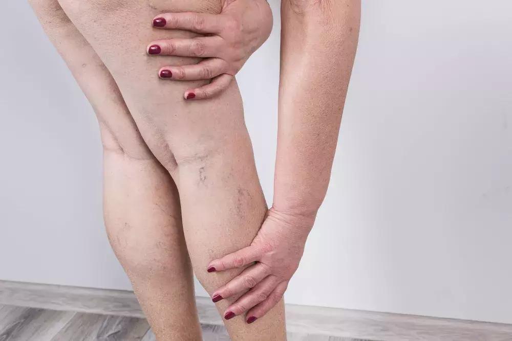 小腿粗做什么动作才能瘦腿,腿粗的看过来4个简单动作