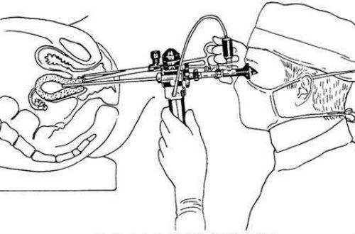 妇科医生都会做宫腔镜吗,妇科宫腔镜检查注意事项