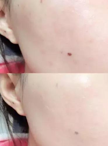 气垫夏天好用的,气垫好用不脱妆推荐平价