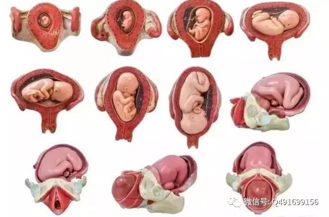 女性切除卵巢子宫后有无影响,子宫切除影响女性快乐感