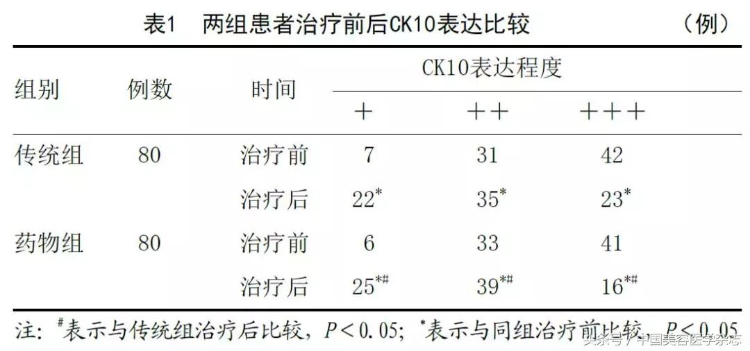 药物水光注射治疗*褐斑黄**对患者CK10、SOD及MDA表达水平的影响
