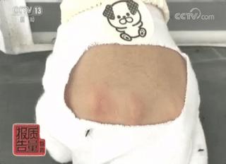 用了驱蚊液还被蚊子咬了,驱蚊贴用了好像没用