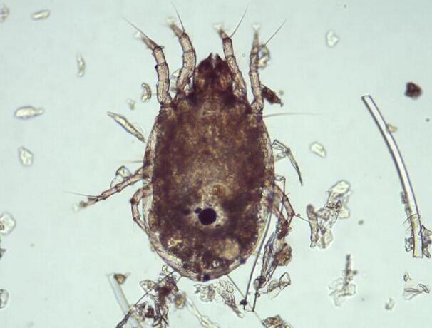 寄生在人脸上的螨虫有多可怕,脸上有螨虫要忌口